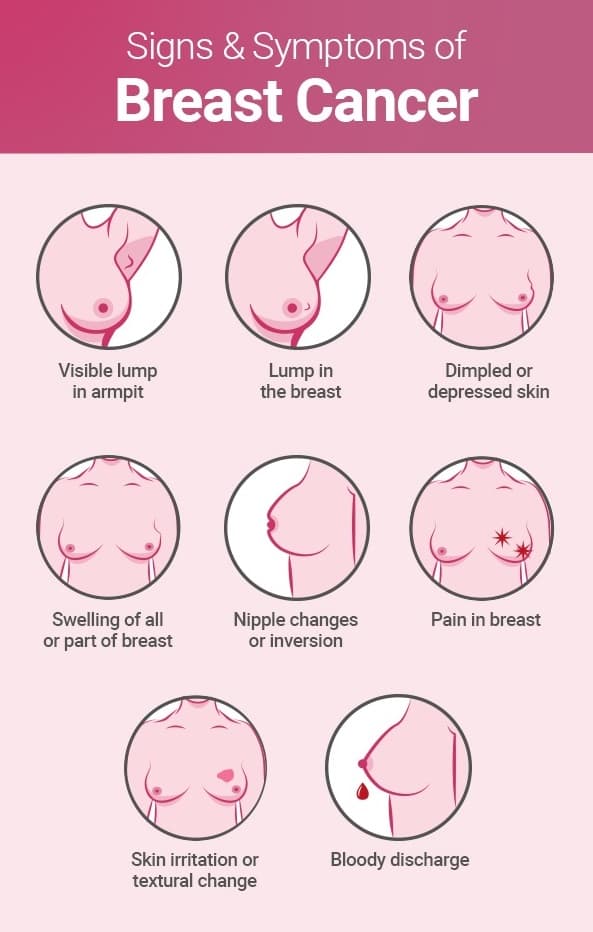 Breast Anatomy