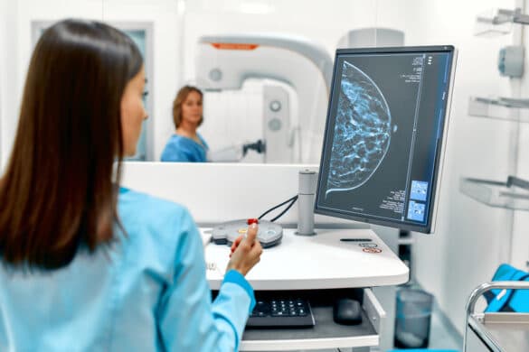 Stage IV Breast Cancer: No Longer a Terminal Diagnosis