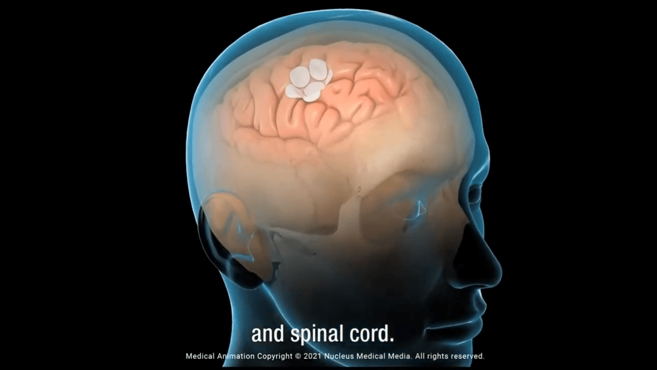 Latest Advances in Cancer Research